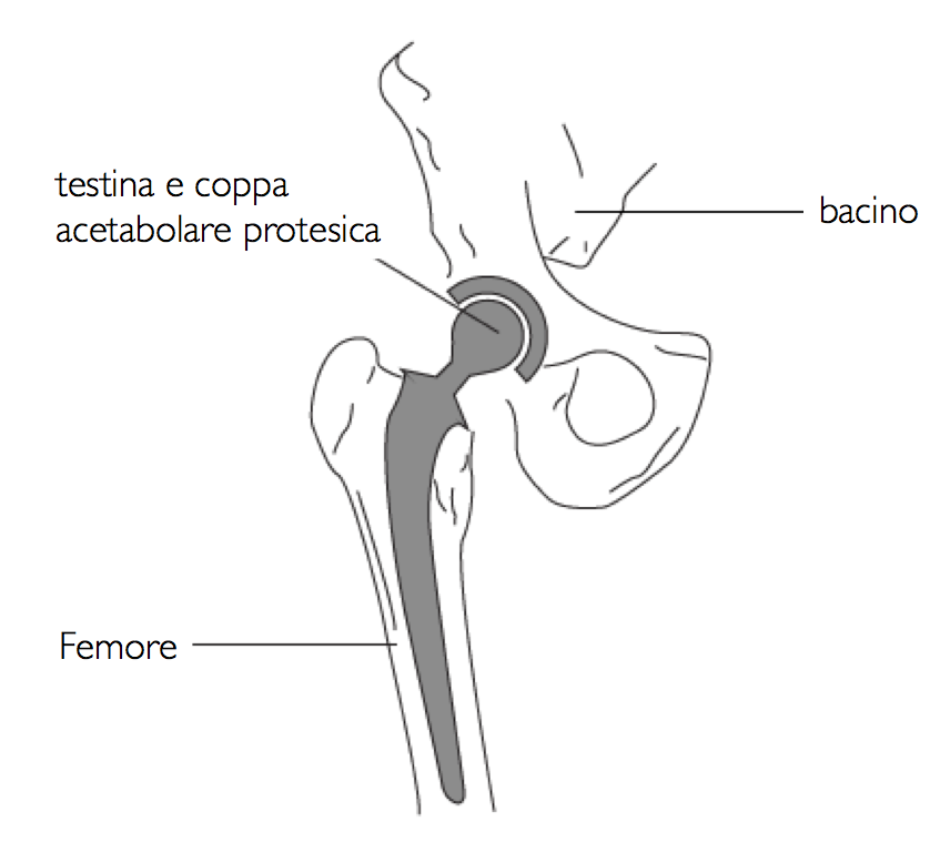 PTA2