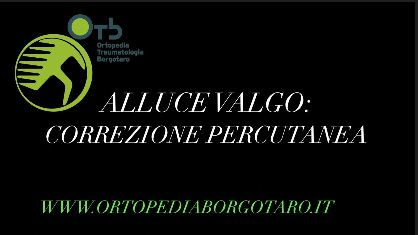 alluce valgo