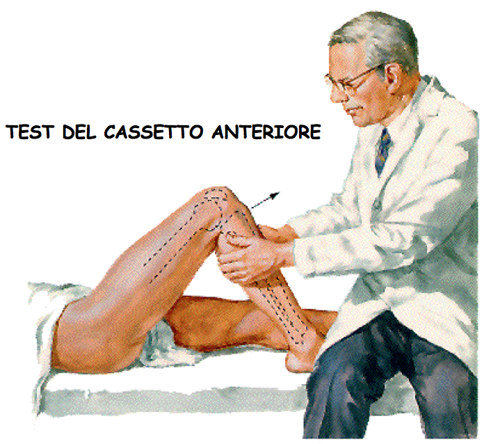 cassetto anteriore