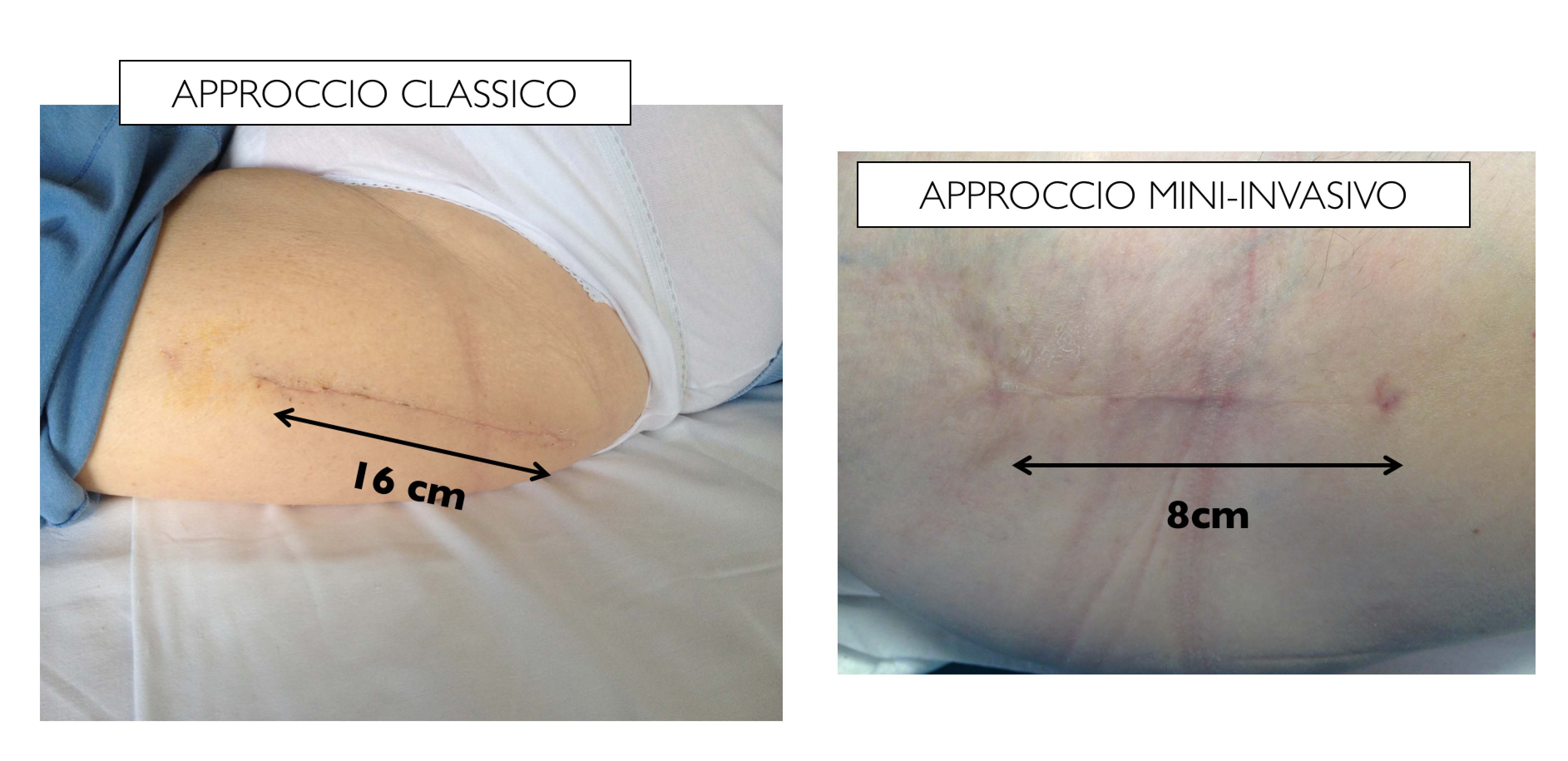 incisione mini copia