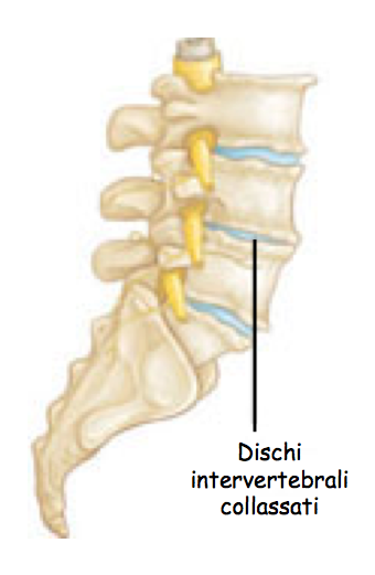 schiena6